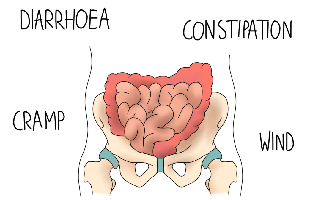IBS: Irritable Bowel Syndrome