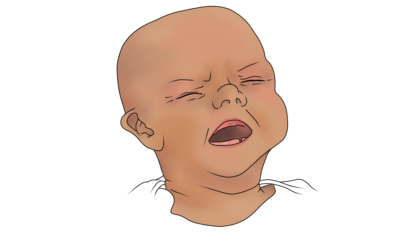 Colic: What Do We Know About It?