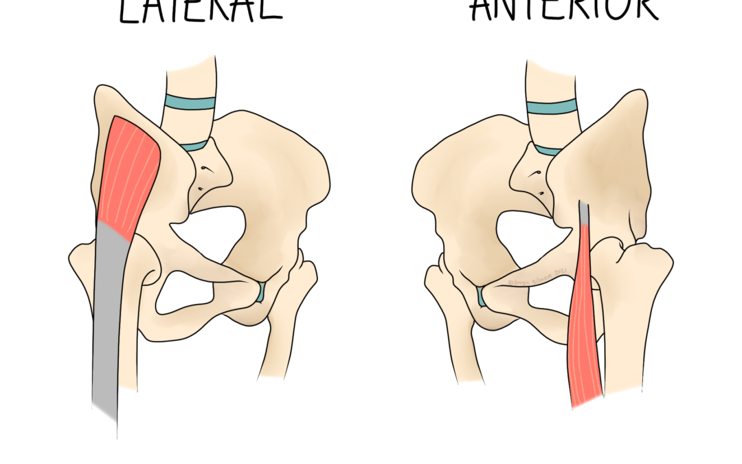 Snapping Hip Syndrome