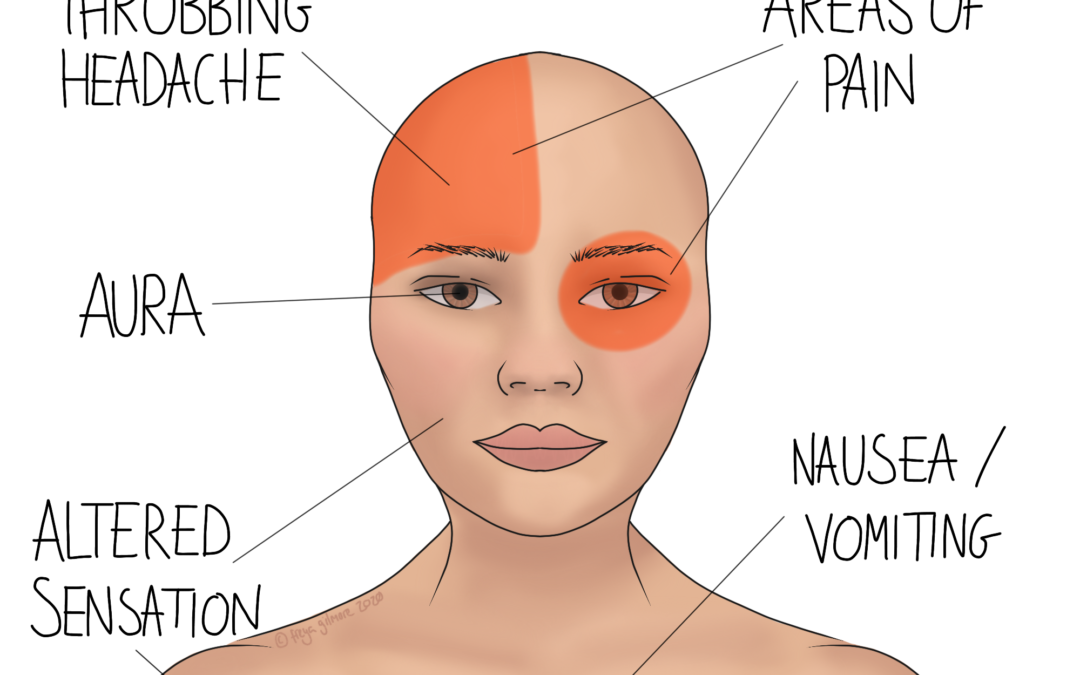 Migraine Prevention