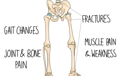 Osteomalacia
