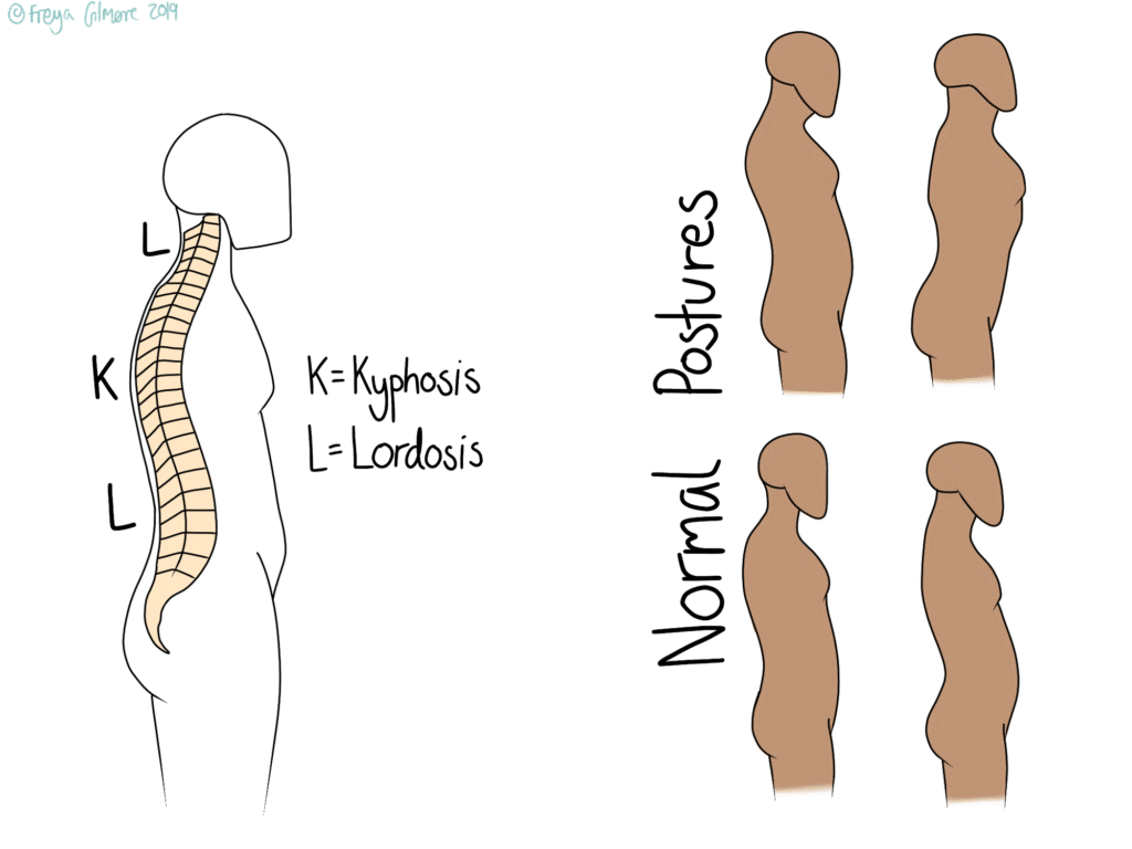 Posture: kyphosis and lordosis