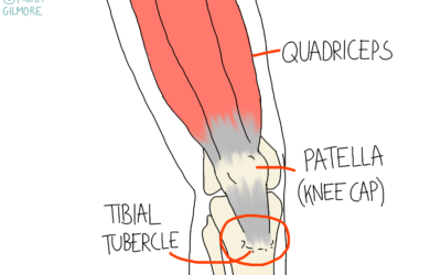 Kids’ Sports Injuries
